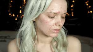 Potong jahe dan kuyit lalu masukkan kedalam air yang sudah mendidih 3. Jangan Main Hentam Je Ikut Petua Perempuan Ini Cerita Apa Yang Dia Pernah Cuba Soscili