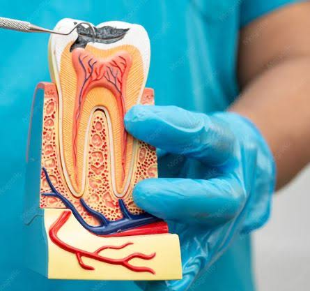Root Canal Treatment (RCT) product image