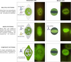 Image result for ANA Staining Pattern