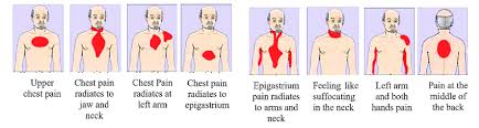 Image result for Chest Pain