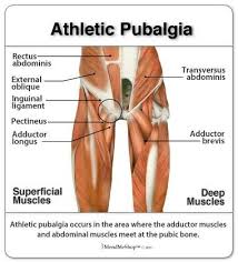 Sports Medicine Orthopedic Surgeon Kho Health Connect Athletes With The Best Healthcare Providers And Athleti Athletic Injuries Hernia Exercises Sports Injury