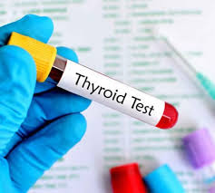 Image result for Thyroid Function Test