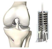 By definition a strain is a partial or complete disruption of the musculotendinous unit  4 . Kreuzbandriss Wikipedia