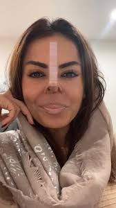 #عمل_زیبایی #آنجلیناجولی #عمل #طنز 😃