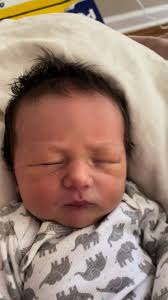 Effective Remedies for Clogged Tear Duct in Infants