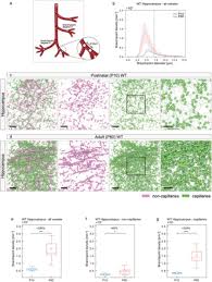 Pain under your ribs and the area is tender to touch. Hierarchical Imaging And Computational Analysis Of Three Dimensional Vascular Network Architecture In The Entire Postnatal And Adult Mouse Brain Biorxiv