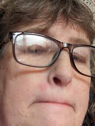 Anyone with pulmonary hypertension here? How has a CPAP helped?