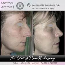 Alexandre Dion (@dr.alexandre_dion) • Instagram-foto's en -video's