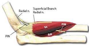 Radial Tunnel Syndrome Hand Orthobullets