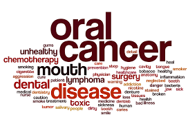 If you notice any of these changes, contact your dentist or health care. Oral Cancer Screening Have You Had Yours Mountain Aire Dentistry In Broomfield