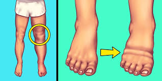 Plus, tips on how to avoid it in the first place. 7 Signs You Re Eating Too Much Salt