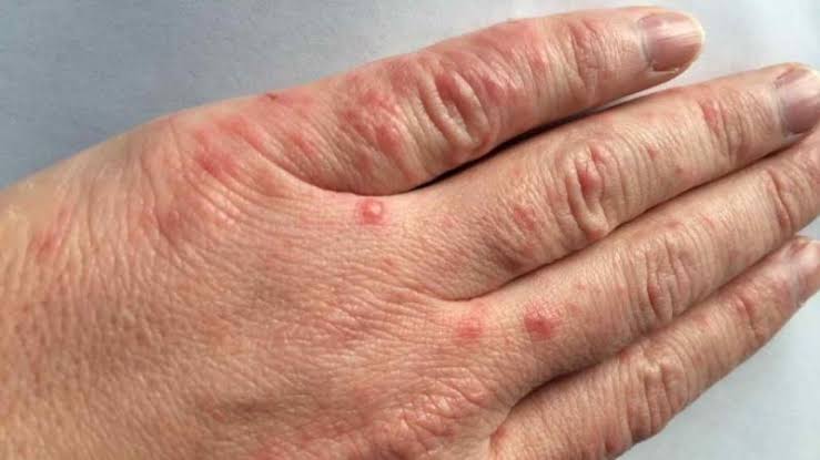 images?q=tbn:ANd9GcTRmhfgxsdpvbJFsIio543...Q&usqp=CAU