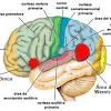 Expressive aphasia, also known as broca's aphasia, is a type of aphasia characterized by partial loss of the ability to produce language (spoken, manual, or written), although comprehension generally remains intact. 3