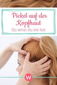 pickel auf der kopfhaut ursache symptome und heilung wunderweib pickel auf der kopfhaut pickel ausschlag im gesicht