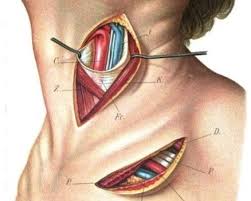 Pin On Health Thyroid