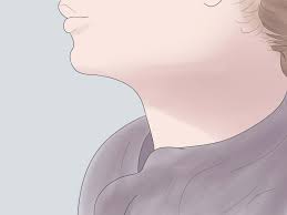 Check spelling or type a new query. How To Get Rid Of A Hickey Fast 9 Steps With Pictures Wikihow