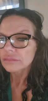 Fall Filler..Wow!! Filler to the Nasolabial Folds and Marionette Lines!  Just look at the lift! Completely gone! This is why I love Derma Filler!  Instant lift which will improve more in approximately