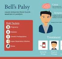 Bell's Palsy vs Stroke: What's the Difference? – Griswold
