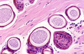 Image result for Lankesteria