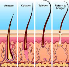 The medical condition telogen effluvium can develop as a consequence of severe mental stress, such as the loss of a loved one. Why Is My Hair Falling Out 5 Causes Of Hair Loss And Exactly What To Do