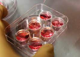 Egg Donation Price Fixing Lawsuit Did Fertility Clinics Conspire To Limit Payments To Women
