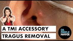 .new cyst removal videos, newest cyst popping videos, new spa blackheads removal, biggest watch on youtube. E9qgafdqqhmgdm