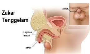 Ini adalah versi stabil, diperiksa pada tanggal 10 februari 2021. Berkhatan Zakar Tenggelam Boleh Ke Klinik Dr Hasbi