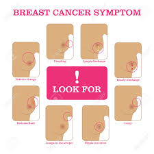 Breast cancer symptoms pictures, download this wallpaper for free in hd resolution. Breast Cancer Symptoms Infographic Royalty Free Cliparts Vectors And Stock Illustration Image 84171015