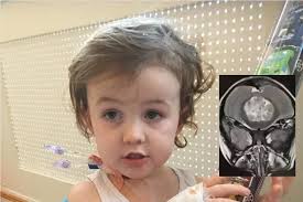 A mother's intuition diagnosed son's brain tumour before the medics