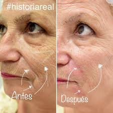 Dr. Edward Serrano Médico estético, Sabadell