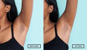 Wax armpit (hair removal) honey cold wax by esme organics in this video, i will show how i wax my armpit using. How To Wax At Home Self Self