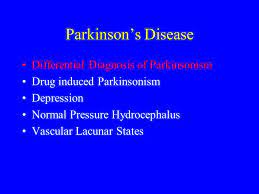 Parkinson S Disease Pd Ppt Download