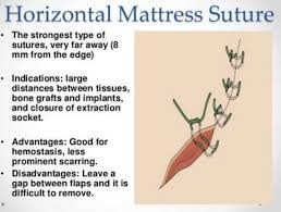 Its disadvantage is a relatively high pr. Mattress Stitch Medical Novocom Top