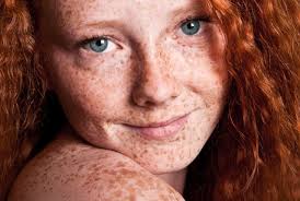 Why Do Some People Especially Red Heads Have Freckles Sproeten Meisje Sproet Roodharigen