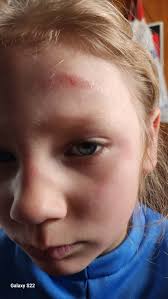 daughter in critical care with kidney failure