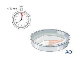 Image result for Tooth Avulsion