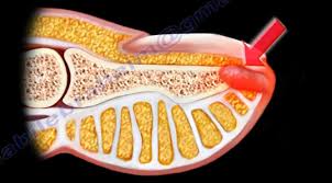 Image result for Glomus tumor