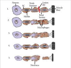 Producing multiple photons, however, opens up a new attack known as the photon number splitting (pns) attack shown above in figure 6. Pns Axon Injury And Regeneration 1 During The First Days After Injury Download Scientific Diagram