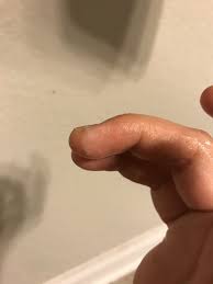 dry / cell slough – The Cervical Mucus Project