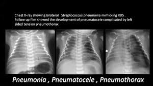Pin By White Coat Bites On Pediatrics Radiology Pet Ct Radiography