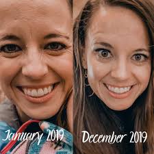 Can a Supplement Really Turn Back Time? My Honest SeroVital Journey by  Heidi Pierce