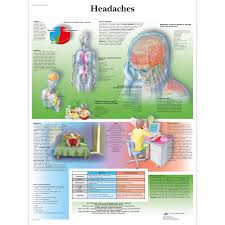 Types Of Headache Chart Sample Bill Of Sale For Automobile