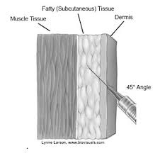 Maybe you would like to learn more about one of these? Pinkbook Vaccine Administration Cdc