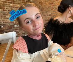 Epidermolysis Bullosa Lounge :)