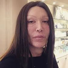 pete burns