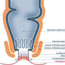 Analfissur, Analthrombose, Analekzem: Symptome und Therapien | DR. KADE