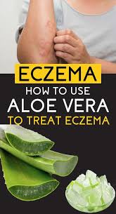 Why And How Aloe Vera Is Being Claimed As One Of The Best Solutions To Eczema And Other S Home Remedies For Eczema Aloe Vera For Eczema Natural Eczema Remedies