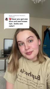 Replying to @Keturah Thomas this comment made my day! And i felt like it  would be nice to address my eye as its not simething i normally talk about  🥺👁️ #fyp #foryou #eye #eyes