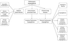 Aspergillosis (aspergillus infection) is a fungal infection. Pulmonary Aspergillosis What The Generalist Needs To Know The American Journal Of Medicine