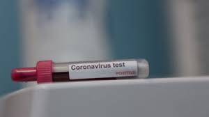 Este clar că măsura carantinării e eficientă dacă e aplicată corect. Noi Restrictii In Romania Si In Ue Din Cauza Coronavirusului Romania A Inregistrat 49 De Cazuri In 24 De Ore Mai Mult De Jumatate In Bucuresti Mobile